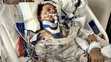 HAWKEYE Star Jeremy Renner Reveals The Horrific Injuries He Suffered In Emotional And Inspiring Interview